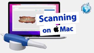 Medit Scanning on Mac | Intraoral scanners compatible with Mac computers