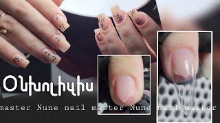 Օնիխոլիզիս և  գարնանային դիզայն _ Nune nail master ️