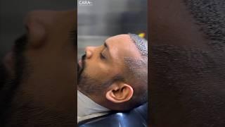 Head Wash After Hair Transplant | Scabs Removal Hair wash