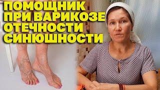 МОЩНОЕ СРЕДСТВО ОТ БОЛИ В НОГАХ ЭФФЕКТИВНОЕ ЛЕЧЕНИЕ ВАРИКОЗА  @natureMarusya