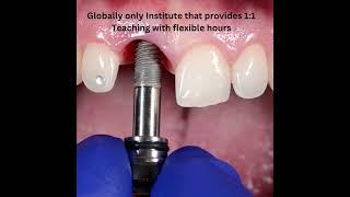 Dental Implant Training Courses