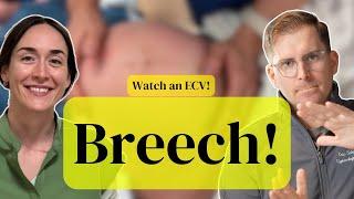 OBGYN Discusses Breech Baby! When and Why Does it Matter?