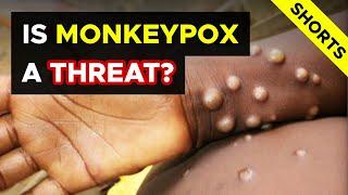 Doctor explains: Is MONKEYPOX a Threat? (June 2022 update)