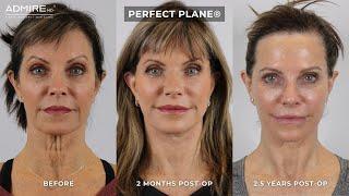 Preserving Long-Term Surgical Results at AdmireMD Plastic Surgery + Skin Clinic #Scottsdale #skin
