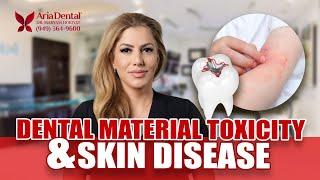 Dental Material Toxicity and Skin Disease | Aria Dental | Maryam Horiyat DDS.