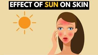 The Effect of the Sun on the Skin.