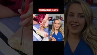 Doctor reacts to callus shaving device