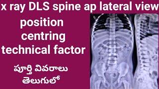 x ray DLS spine ap lateral view in telugu