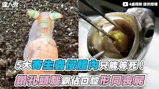 【5大寄生蟲侵體內只能等死！ 鑽孔頭腦霸佔口腔形同喪屍】｜@4處探索