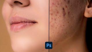 Photoshop High End Skin Retouching || Face Retouching || DK ARNIYA