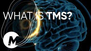 What is TMS? How does TMS work? MagVenture TMS Therapy