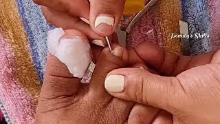 Deep nail cutting(Part2) | Beauty's Skills