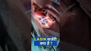 What Is Lasik Surgery?