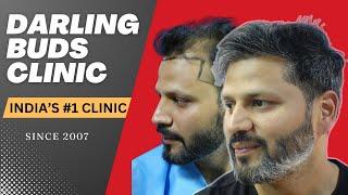 Hair Transplant in Chandigarh |Best hair transplant clinic