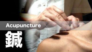 鍼灸師から鍼を受けた | Acupuncture