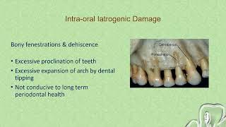 Deleterious Effects of Orthodontic Treatment