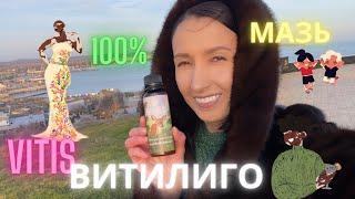 КРЕМ-МАЗЬ ОТ ВИТИЛИГО СО 100% РЕЗУЛЬТАТОМ🫵🩷