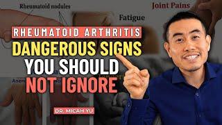 SHOCKING: Serious Complications of Rheumatoid Arthritis! | Rheumatologist Dr. Micah Yu