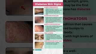 Diabetes Warning Signs: 5 Skin Changes That Could Save Your Life  #diabetes #ytshorts #nutrition