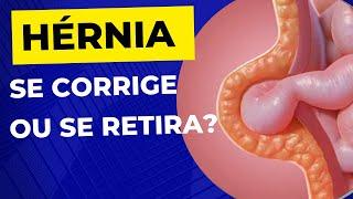 Como é a CIRURGIA DE HÉRNIA? A hérnia é retirada ?