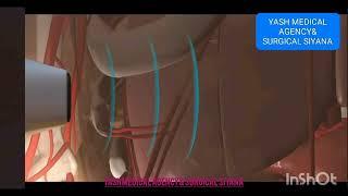 product - ULTRASOUND GEL ( Sonography gel) kyon important hai ? How to use ? YASH MEDICAL AGENCY&Su.