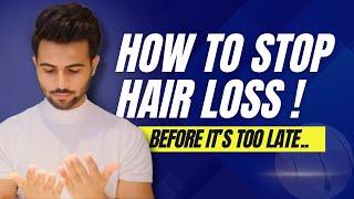 How To Stop Hair loss before it’s too late.. | Male Pattern Baldness , Thinning Hair | Tarun Molri