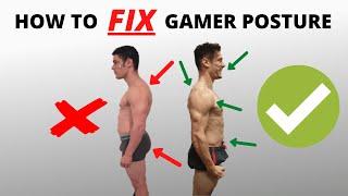 How to FIX 'gamer posture'