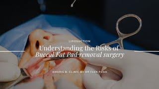 Understanding the Risks of Buccal Fat Pad Removal Surgery | Amaris B. Clinic by Dr Ivan Puah