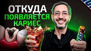 5 заблуждений о КАРИЕСЕ, в которые ВСЕ верят! Почему появляется кариес на самом деле?