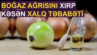 Boğaz ağrısı və öskürəyi dərhal kəsən üsul — XALQ TƏBABƏTİ