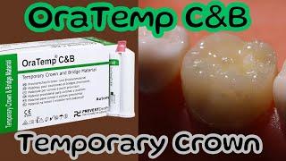 OraTemp C&B ️ Temporary Crown Preparation  #atozkidsdental #prevestdenpro