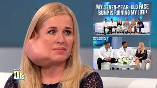 My Journey with a Parotid Tumor on The Doctors TV Show Changed My Life