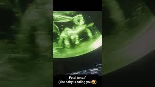 Baby is calling you#imaging #ultrasound #medicalimaging #learning #medicine #gynecologist #viral