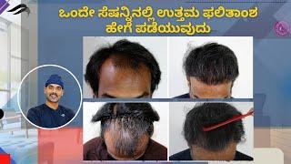 Hair Transplant In Bangalore | Best Surgeon Clinic & Cost Of Hair Transplant In Bangalore