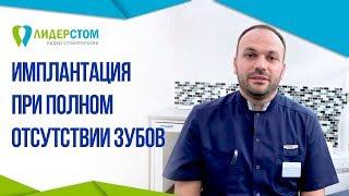 Имплантация зубов при полном отсутствии зубов.  Полная имплантация зубов.