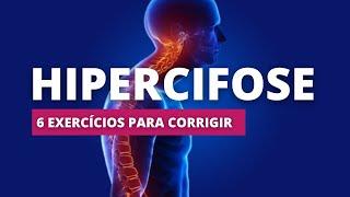 PILATES NA PAREDE | HIPERCIFOSE | Como corrigir a postura corcunda (6 Exercícios)