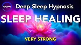 Deep Sleep Hypnosis  (Fast Healing) VERY POWERFUL!! Healing Sleep