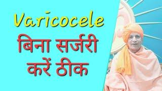 वेरिकोसिल का प्राकृतिक इलाज | Varicocele Treatment without surgery | वेरिकोसेल ठीक करें बिना सर्जरी