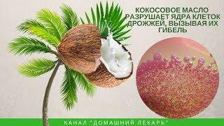 Как вылечить молочницу за 1 месяц? Кокосовое масло - Домашний лекарь - выпуск №245