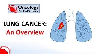 Lung Cancer: An Overview