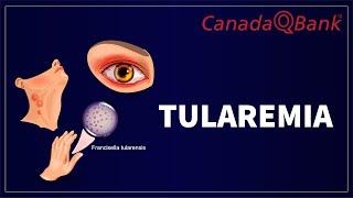 Tularemia: Causes, Symptoms, Diagnosis & Treatment | CanadaQBank