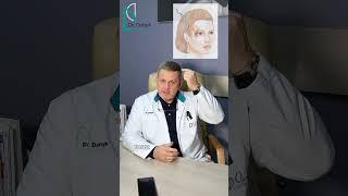 Омолодження обличчя #пластическийхирург #plasticsurgery #лифтинглица