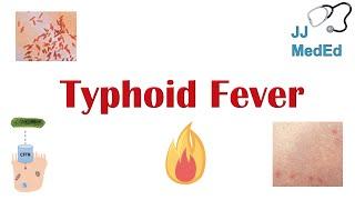 Typhoid Fever: Pathogenesis (vectors, bacteria), Symptoms, Diagnosis, Treatment, Vaccine