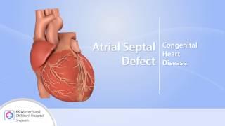 Heart Conditions – Atrial Septal Defect (ASD)