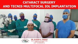 Cataract Surgery and Tecnis Multifocal IOL Implantation...Dr. Suresh K Pandey