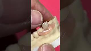 dental on videos