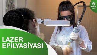 Lazer Epilyasiyası - Bonum Medical