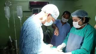 Hydatid Cyst of Abdomen. Dr.Shahanshah Alam and team at ALMC Hospital. Asansol.