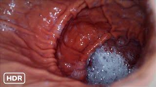 My stomach ^w^️ - ENDOSCOPE VORE HDR 60FPS (Read desc. :'3)