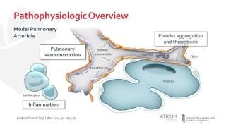 Pathophysiology of Pulmonary Arterial Hypertension